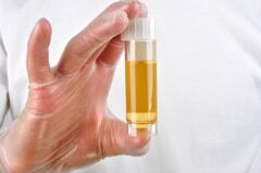 Urine analysis is one of the methods of diagnosing prostatitis